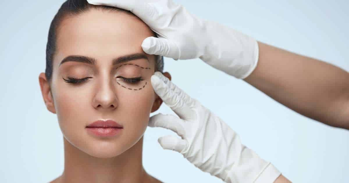 What-Is-a-Blepharoplasty
