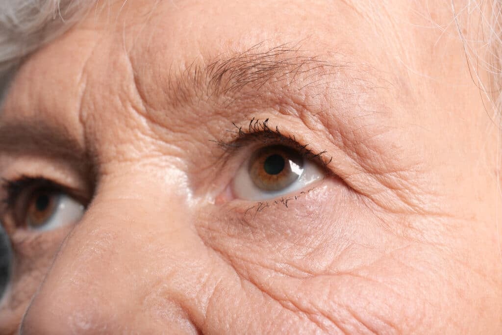 Eyelid Surgery Austin & Dripping Springs