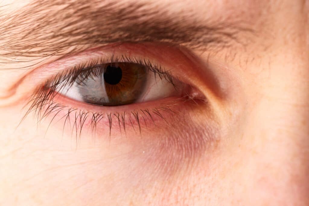 Laser Eye Surgery Austin & Dripping Springs