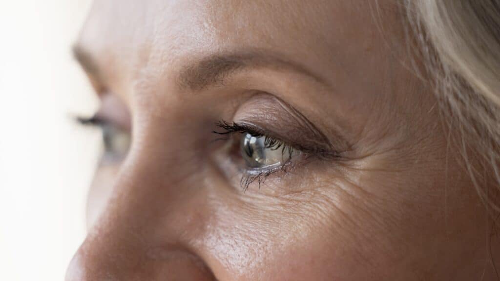 Blepharoplasty