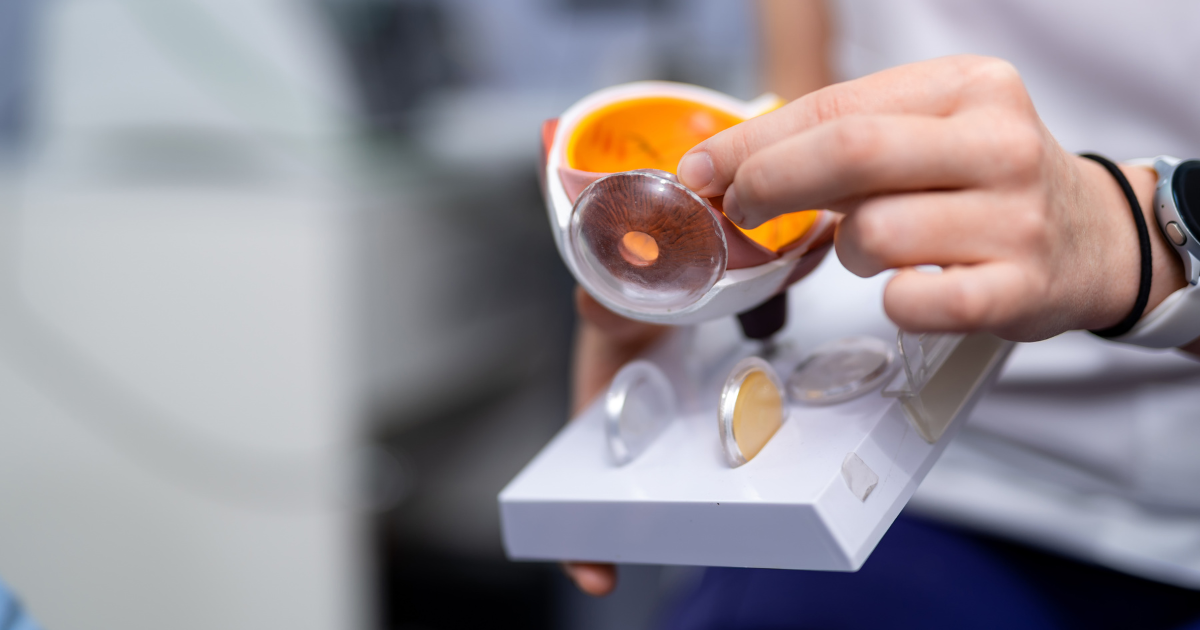 An eye doctor using an eye model to talk about cataracts and intraocular implants.