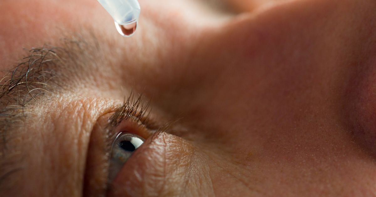 A man places eye drops in his eye to treat his dry eye symptoms.