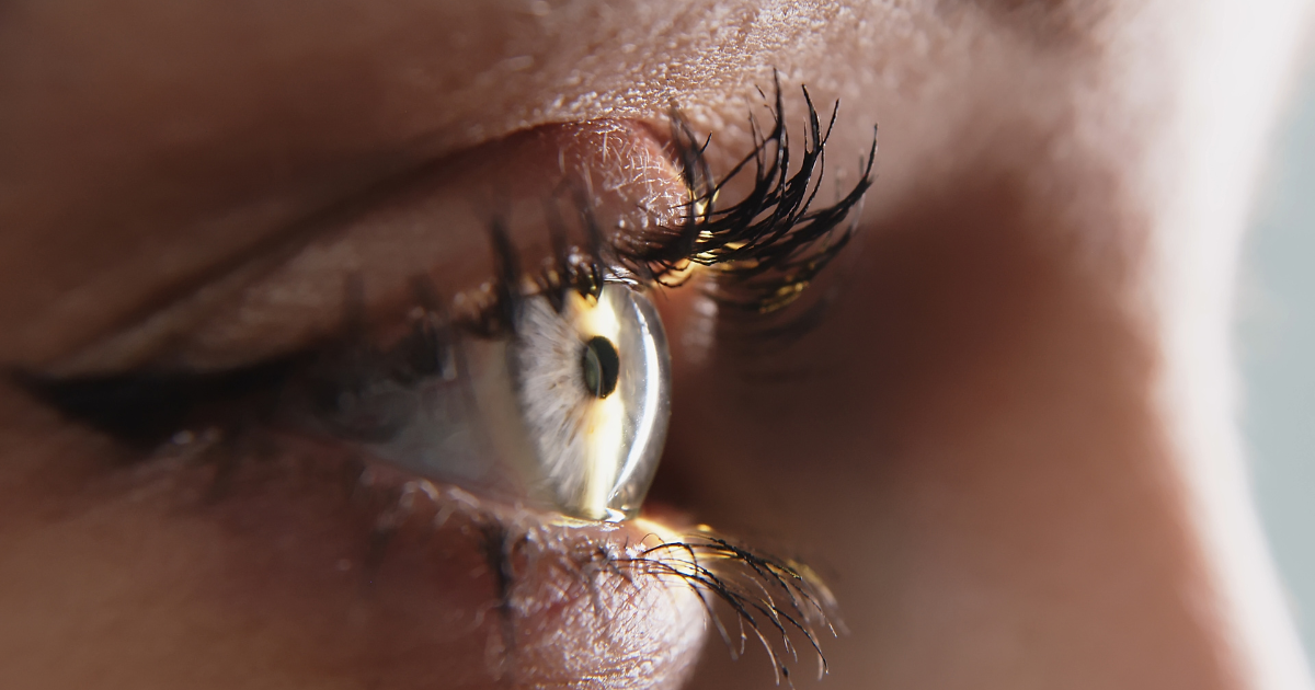What is Glaucoma? Symptoms, Risks, and Prevention